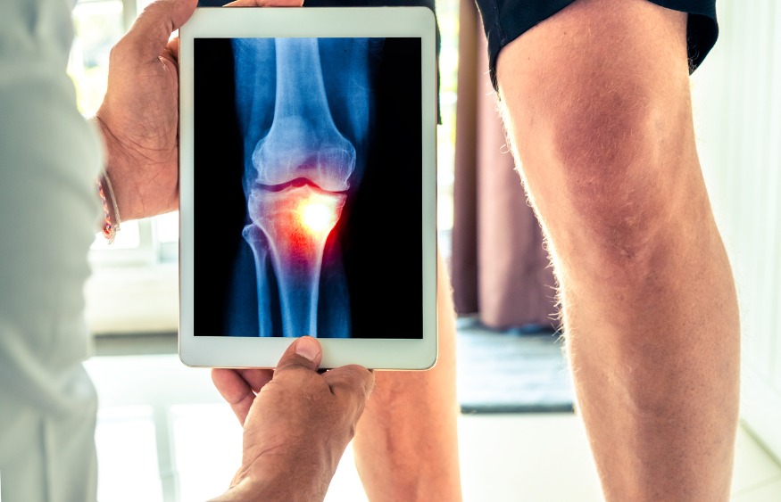  Digital X-Ray Knee Joint Blog